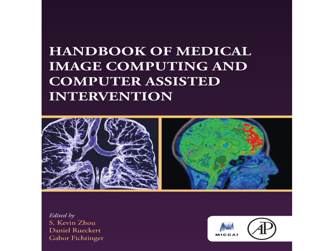 Livro Handbook of Medical Image Computing and Computer Assisted Intervention de Elsevier Inc (Inglês)