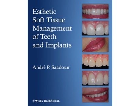 Livro Esthetic Soft Tissue Management of Teeth and Implants de Andre P Saadoun (Inglês)
