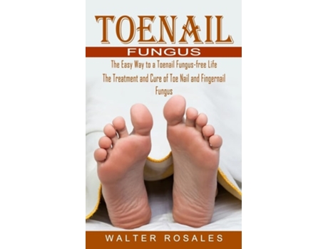 Livro Toenail Fungus: The Easy Way to a Toenail Fungus-free Life (The Treatment and Cure of Toe Nail and Fingernail Fungus) de Walter Rosales ( Inglês )