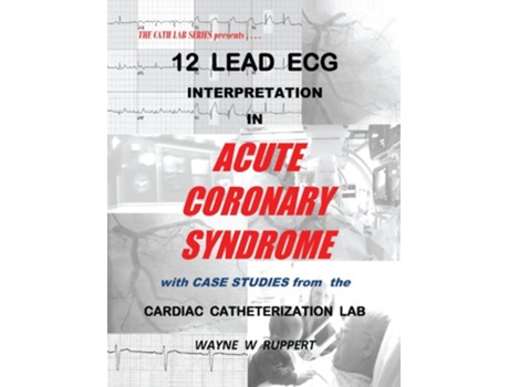 Livro 12 Lead ECG Interpretation in Acute Coronary Syndrome with Case Studies from the Cardiac Catheterization Lab de Wayne W Ruppert (Inglês)