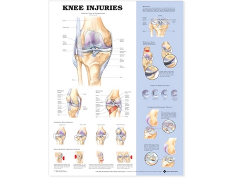 Livro Knee Injuries Anatomical Chart de Anatomical Chart Company (Inglês)