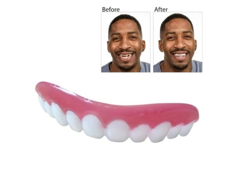 Perfect Smile Veneers Profissional Dub Em Estoque Para A Correção Dos Dentes Para Os Dentes Ruins Perfect Smile Veneers Skmei