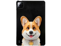Capa Protetora Fina De Tpu Para Tablet Xiaomi Pad 7 Pro/pad 7 Com Estampa De Padrão Slowmoose