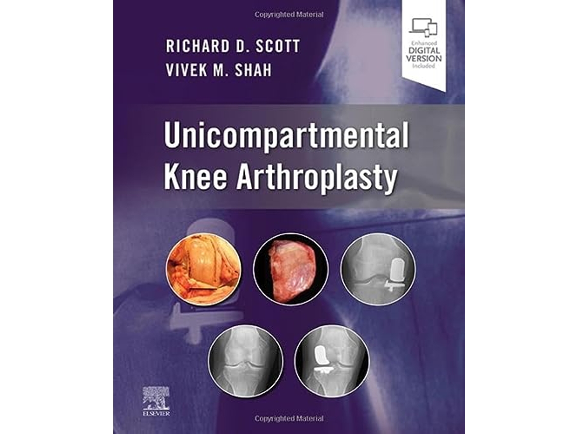 Livro Unicompartmental Knee Arthroplasty de Richard D Scott e Vivek Shah (Inglês - Capa Dura)