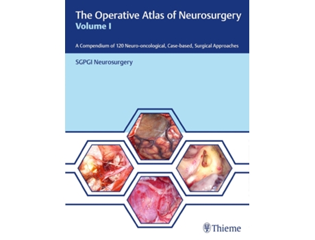 Livro Operative Atlas of Neurosurgery, Vol I de Sgpgi Neurosurgery (Inglês - Capa Dura)