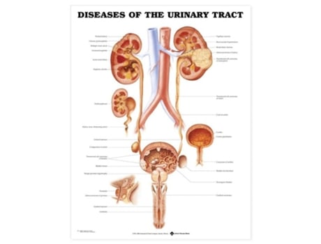 Livro Diseases Of The Urinary Tract Anatomical Chart De Anatomical Chart (inglês)