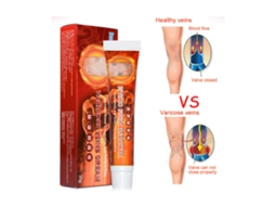 Creme Para Varizes E Vasos Sanguíneos Visíveis, Pomada Medicinal Para Flebites E Inflamações Venosas Jeiibrzui