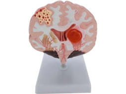Modelo Anatômico Humano com Artérias do Córtex Cerebral para Conferências. SFUSHOS