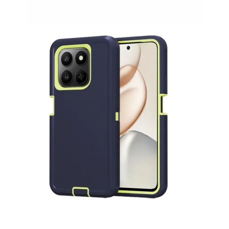 (azul Escuro, Honor Magic7 Lite) Capa Protetora Resistente A Impactos