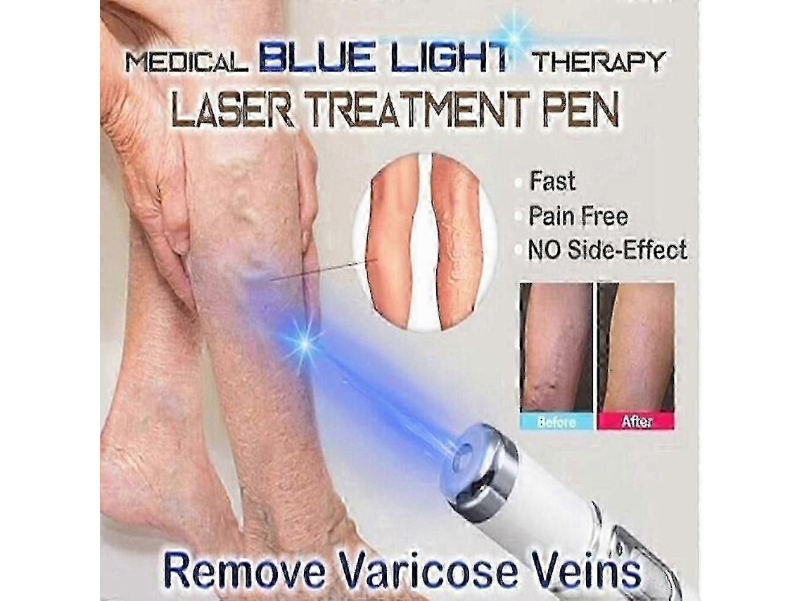 Dispositivo de Terapia Luz Azul para Cuidados com a Pele Acne Rugas Vasinhos Caneta Remoção Cicatrizes GOKOCO