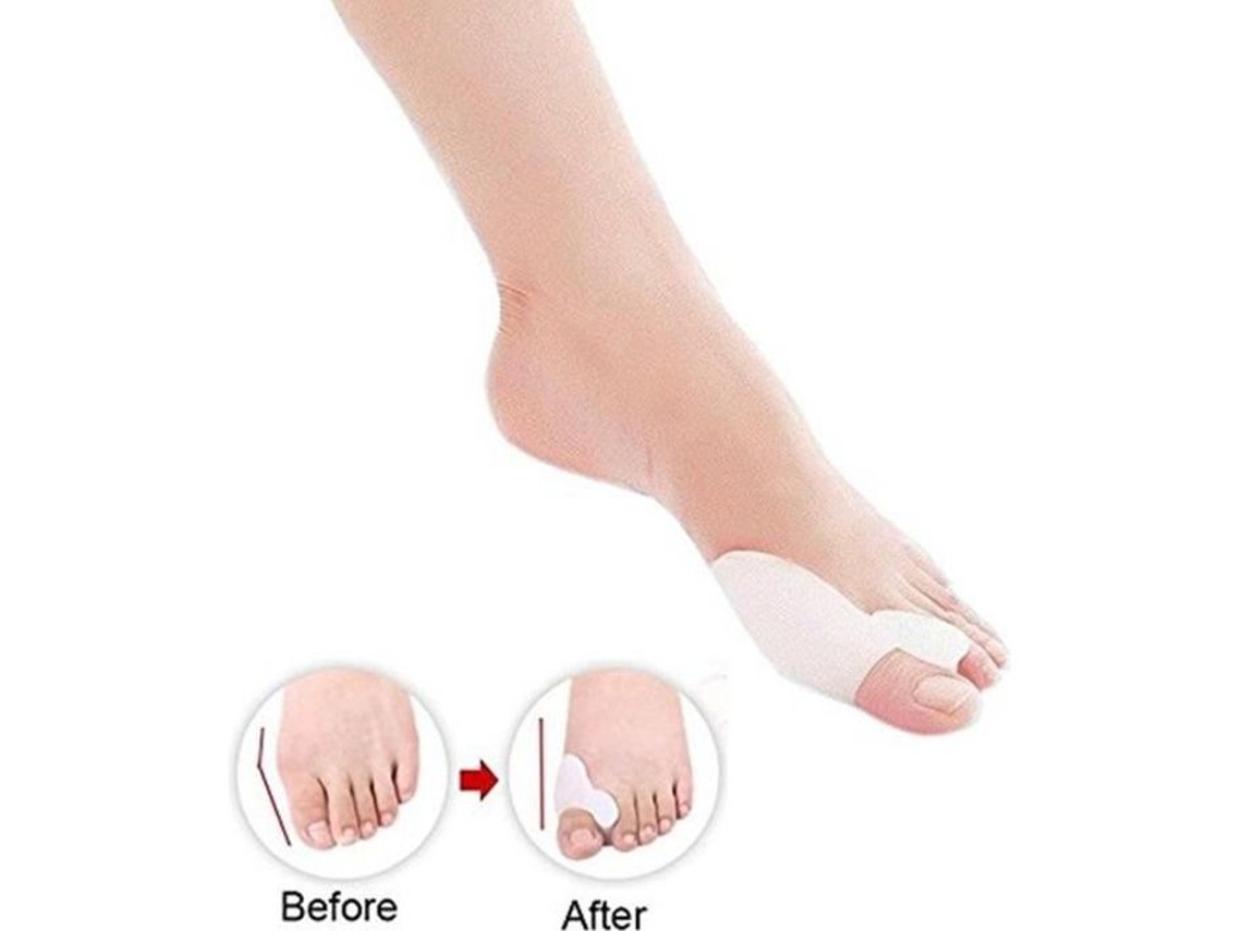 Dr. Pedi Gel Dedo Corretor De Bunion Separadores Hallux Valgus Pro Esticadores De Dedo Corretor De Bunion Alinhamento Beleza (1 Par)