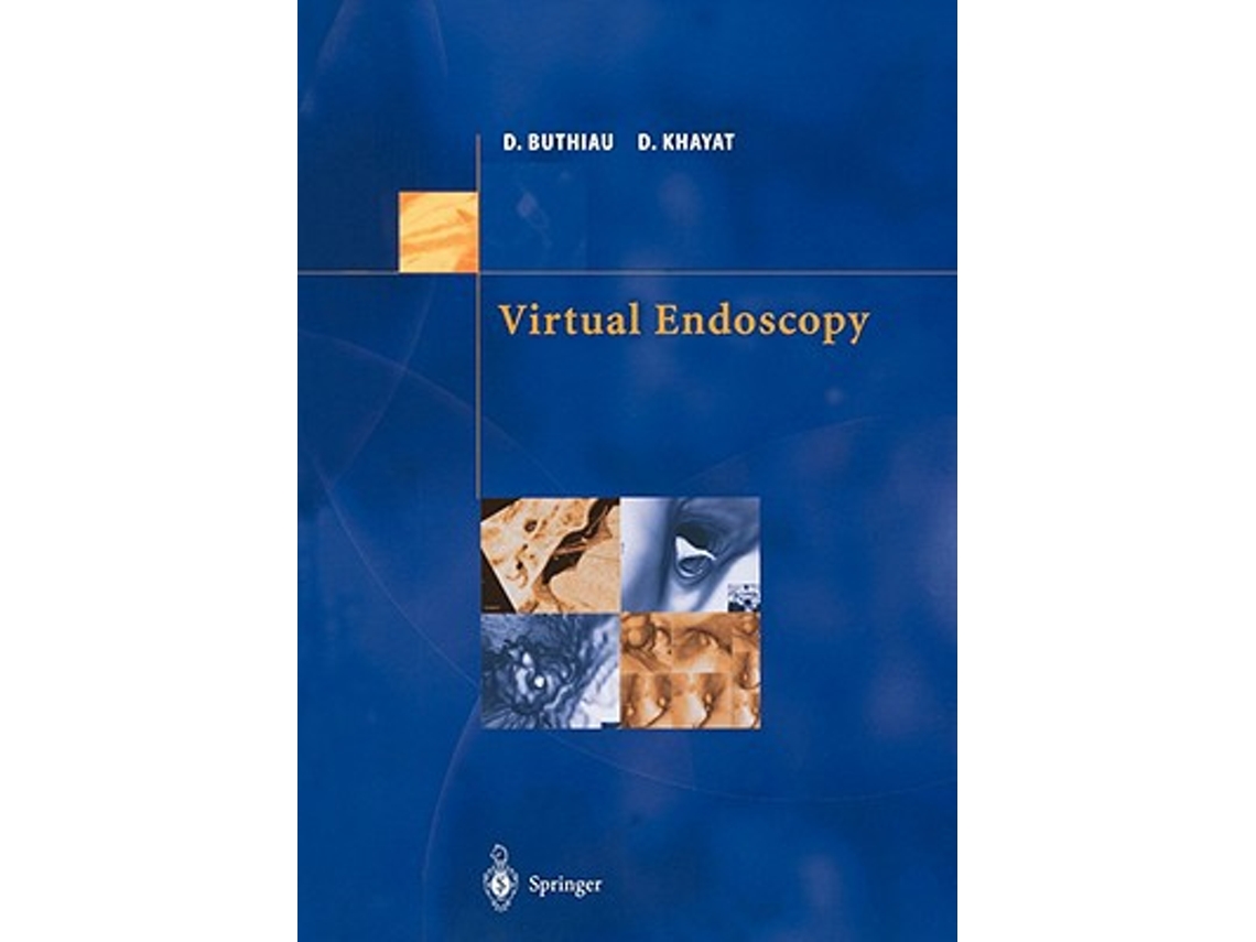 Livro Virtual Endoscopy de Didier Buthiau David Khayat (Inglês)