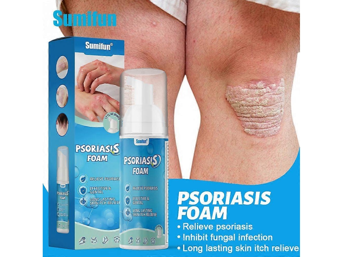 Pele Esbranquiçada, Micose, Mousse De Limpeza Facial, Uso Externo, Tratamento Para Coceira Na Pele