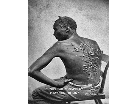 Livro Quotuniversally Despisedquot Is My Skin The Sin? De Dennis Brown (inglês)