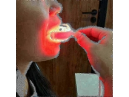 Terapia de Luz Vermelha para o Mais Novo Modelo Tratamento Feridas Dentárias 2025, Aliviando a Gengivite com T Ecnologia Led GOKOCO