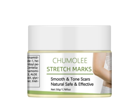 Creme Removedor De Estrias, Hidratante, Reparação De Cicatrizes De Gravidez, Anti Rugas, Firmador, Cuidados Com A Pele Da Maternidade Chumolee
