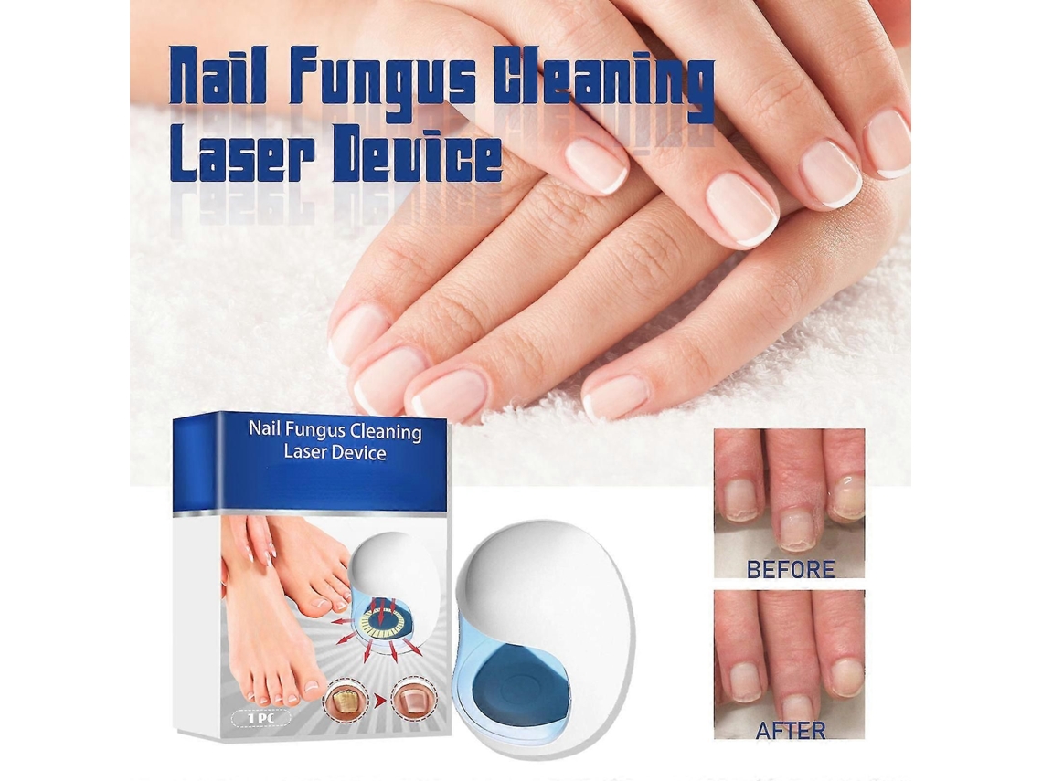 Dispositivo de Terapia Luz Fungos Unhas, Interrupção a Laser Limpeza Lâm Pada Tratamento Fung GOKOCO