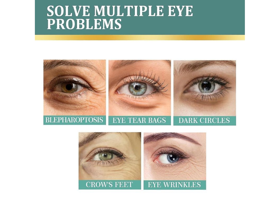 Creme para Olhos Fasst Jasmine com Colágeno e Aloe Vera, Elimina Olheiras, Inchaço e Rugas para Todos os Tipos de Pele