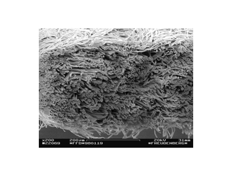 Capa de colchão antiácaro com certificação Ecarf EUROALLERGY