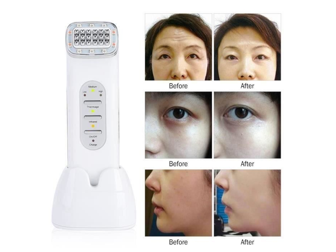 Máquina de massagem facial máquina de rádio frequência máquina facial máquina de rejuvenescimento da pele