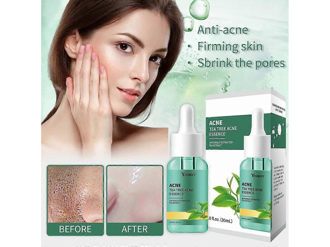 Sérum Facial Hidratante Antiacne Com Óleo De Melaleuca, Tratamento Facial Para Controle Da Acne.
