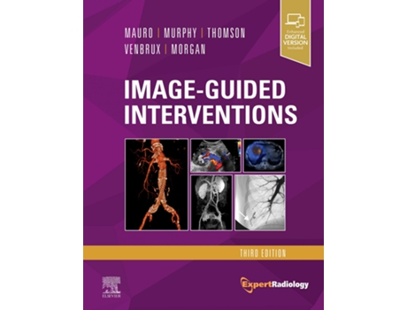 Livro Image-Guided Interventions de VVAA (Inglés)
