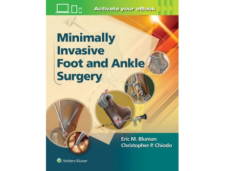 Livro minimally invasive foot & ankle surgery de bluman, dr. eric m., m.d., phd,chiodo, christopher, md (inglês)