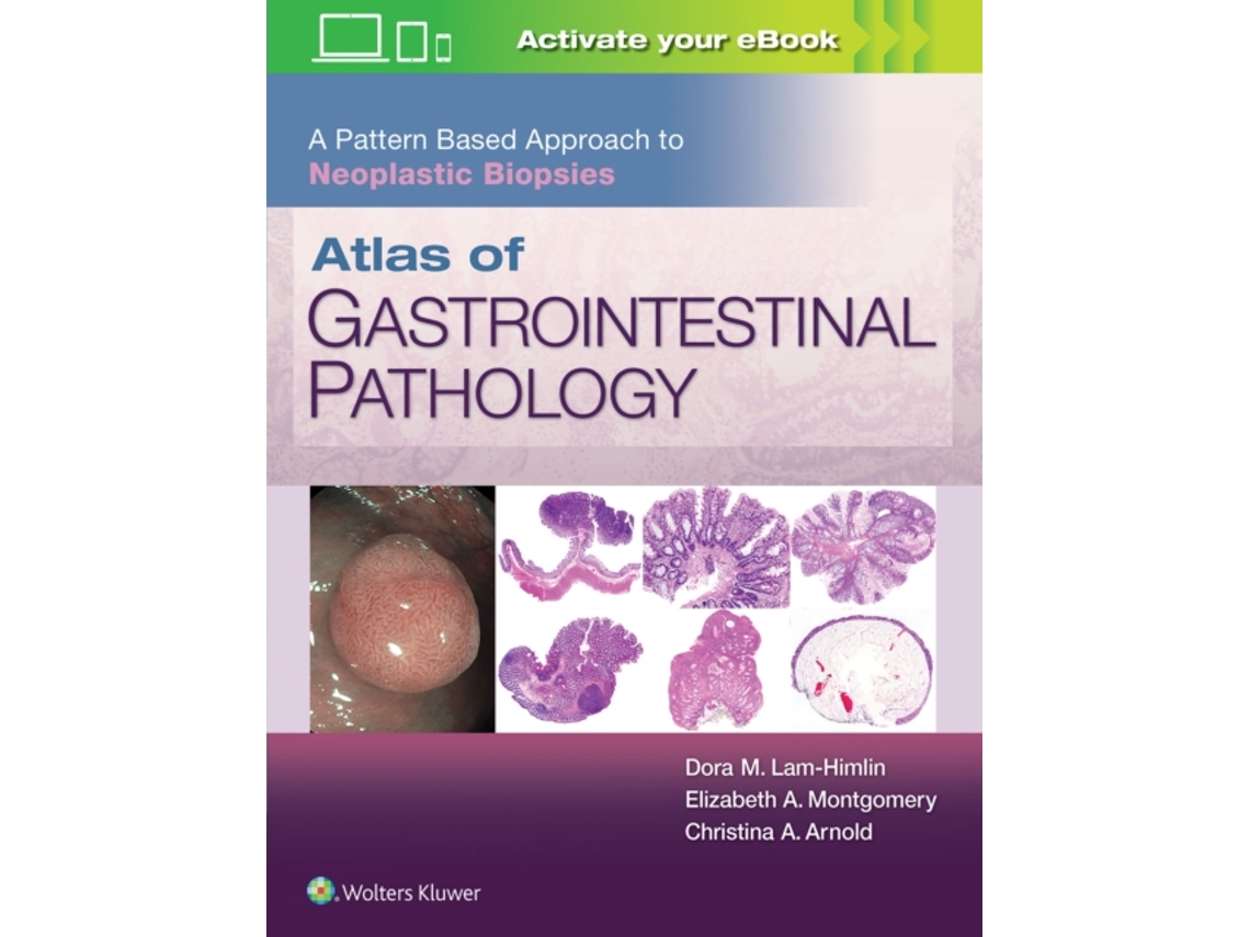 Livro Atlas of Gastrointestinal Pathology: A Pattern Based Approach to Neoplastic Biopsies (Inglês)