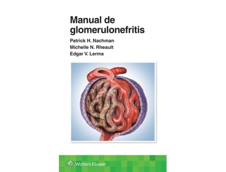 Livro Manual de glomerulonefritis de Patrick Henry Nachman, Edgar V Lerma Md et al. (Espanhol)
