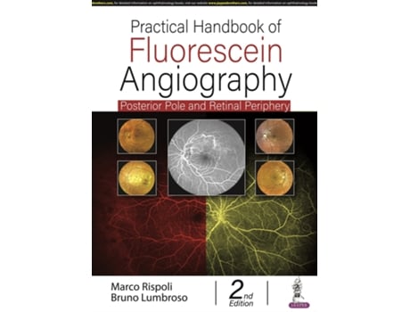 Livro Practical Handbook of Fluorescein Angiography de Marco Rispoli e Bruno Lumbroso (Inglês - Capa Dura)