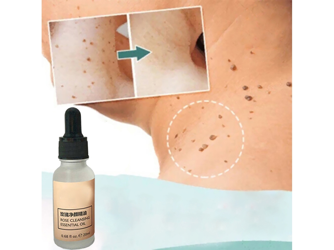 Líquido Para Remoção Eficaz De Manchas Faciais