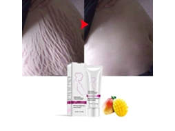 Creme Removedor De Cicatrizes De Acne E Tatuagens De Gravidez