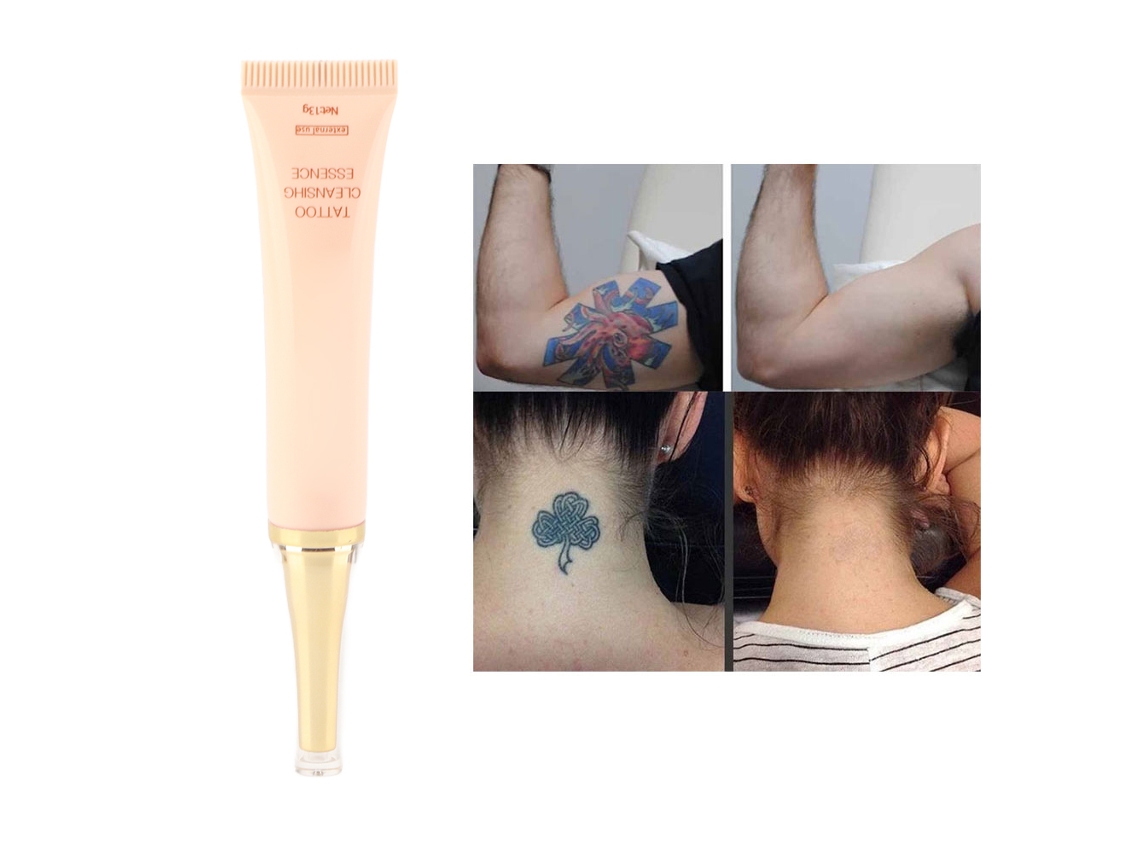 Creme De Remoção De Tatuagem Permanente Segura Sem Dor Limpeza Da Pele