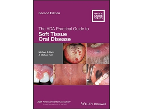 Livro The ADA Practical Guide to Soft Tissue Oral Disease de Michael A Kahn J Michael Hall (Inglês)