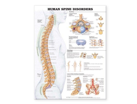 Livro Human Spine Disorders Anatomical Chart de Anatomical Chart Company (Inglês)