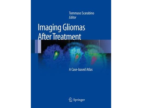 Livro imaging gliomas after treatment de edited by tommaso scarabino (inglês)