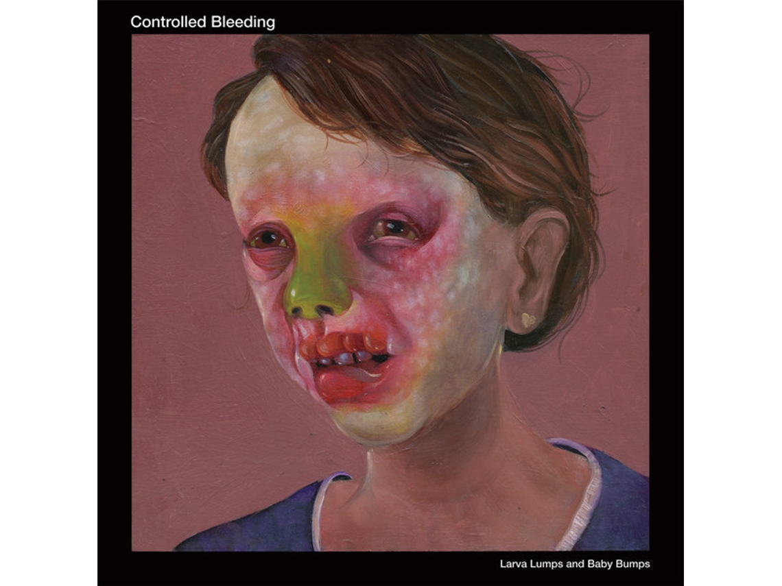 Vinil Controlled Bleeding - Larva Lumps And Baby Bumps