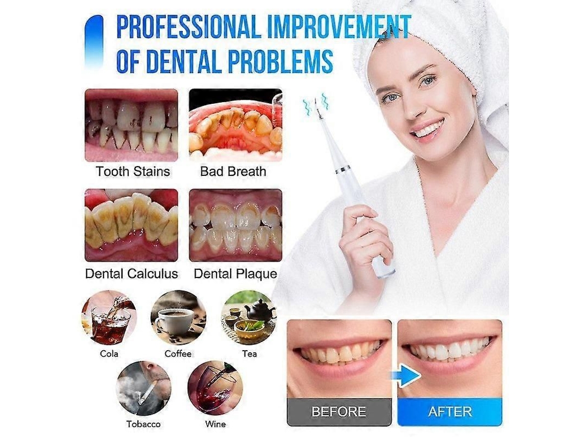 Escova De Dentes Inteligente, Escova De Dentes Elétrica Para Remover Manchas E Tártaro, Clareamento Dental.