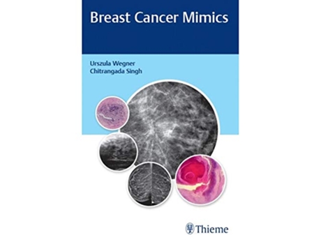 Livro Breast Cancer Mimics de Urszula Wegner e Chitrangada Singh (Inglês)