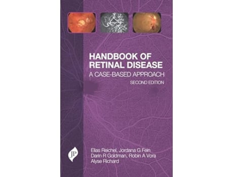 Livro Handbook of Retinal Disease de Elias Reichel, Jordana G Fein et al. (Inglês)