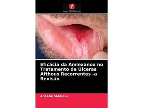 Livro Eficacia Da Amlexanox No Tratamento De Ulceras Afthous Recorrentes -a Revisao De Adeeba Siddique (português)