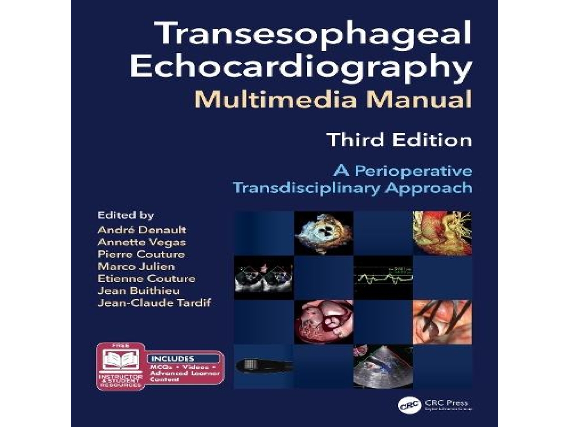 Livro Transesophageal Echocardiography Multimedia Manual de Taylor Francis Ltd (Inglês)
