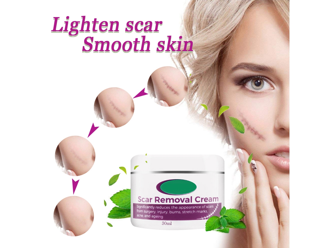 Creme Para Remoção De Cicatrizes Novas E Velhas E Gel Para Remoção De Estrias, Para Homens E Mulheres Vante