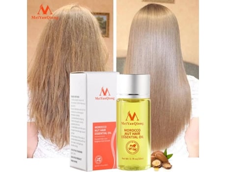 Nuts Cuidados Com O Cabelo Óleos Essenciais Nutrir Reparação De Cabelo Folículos Capilares Essência De Cabelo Flexível E Brilhante Meiyanqiong