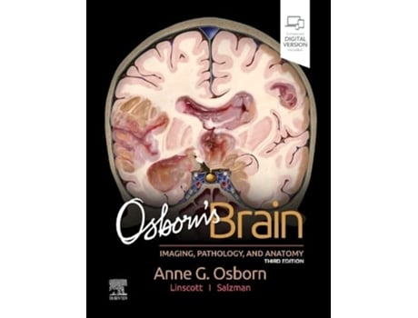 Livro Osborns Brain de Anne G Osborn Md Facr, Luke L Linscott Md et al. (Inglês - Capa Dura)
