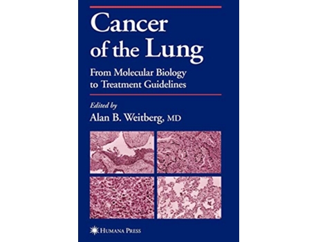 Livro Cancer of the Lung de Editor-Alan B Weitberg (Inglês)