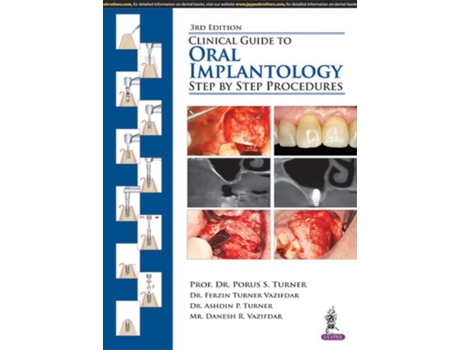 Livro clinical guide to oral implantology de porus s turner,ferzin turner vazifdar,ashdin p turner,danesh r vazifdar (inglês)