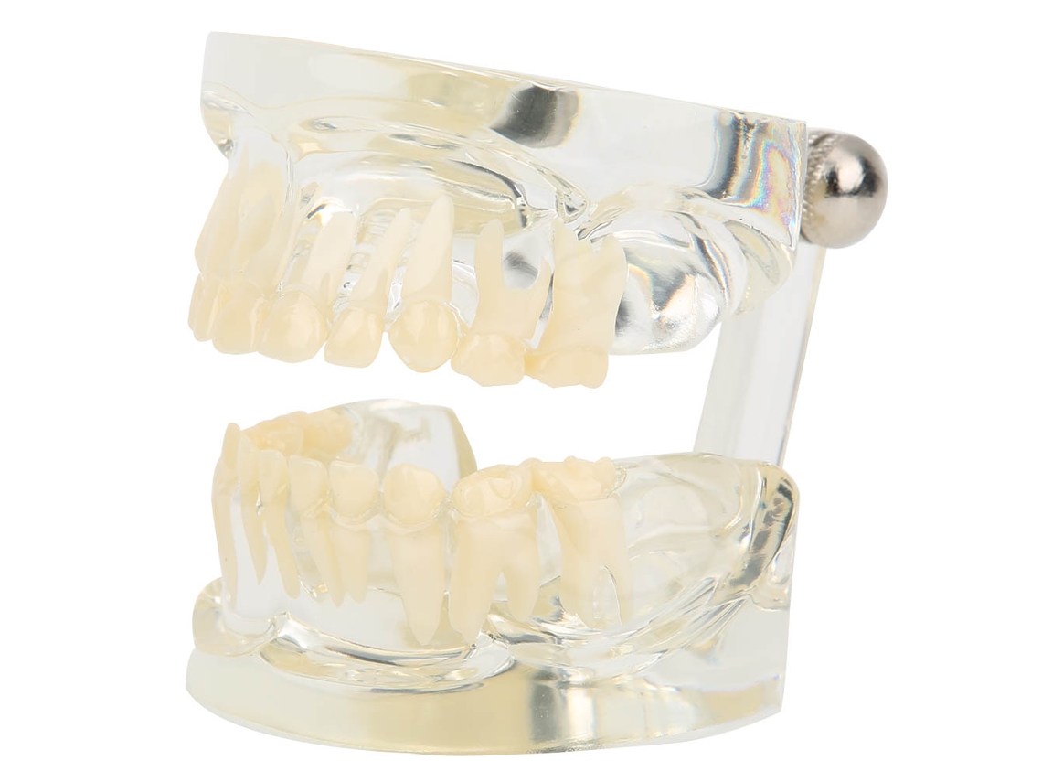 Modelo de Dentes Decíduos Primários Transparente para Ensino em Jardins Infantis, Hospitais e Laboratórios