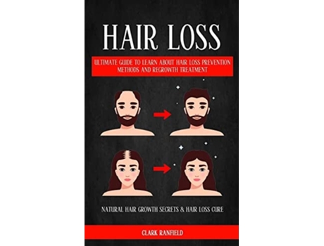 Livro Hair Loss Ultimate Guide To Learn About Hair Loss Prevention Methods And Regrowth Treatment De Clark Ranfield (inglês)