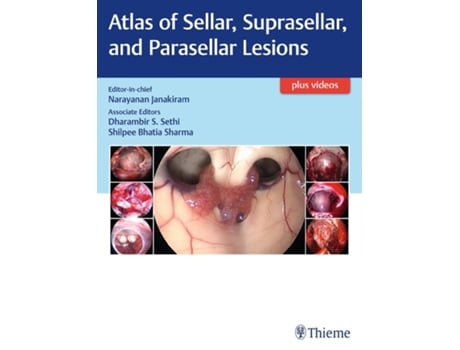 Livro Atlas of Sellar, Suprasellar, and Parasellar Lesions de Janakiram (Inglês - Capa Dura)